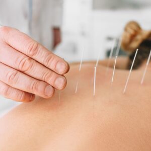 acupuntura-narvaez-fisioterapia